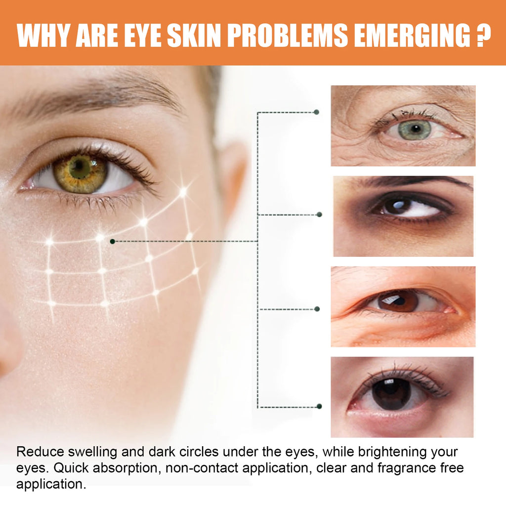 Vitamin C Eye Balm Moisturizing Eye Bag Removal Dark Circles Reduce Fine Lines Anti Puffiness Brightening Eye Cream Stick Qme