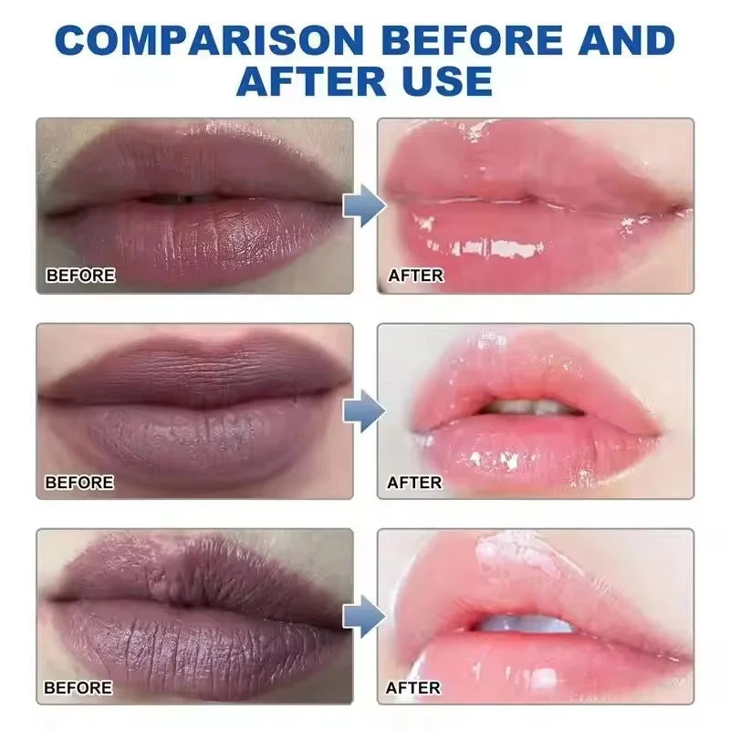Remove Dark Lip Balm Fast Lightening Pink Lip Exfoliating Fade Lip Line Dead Skin Moisturizer Korean Care Products Beauty Health Qme