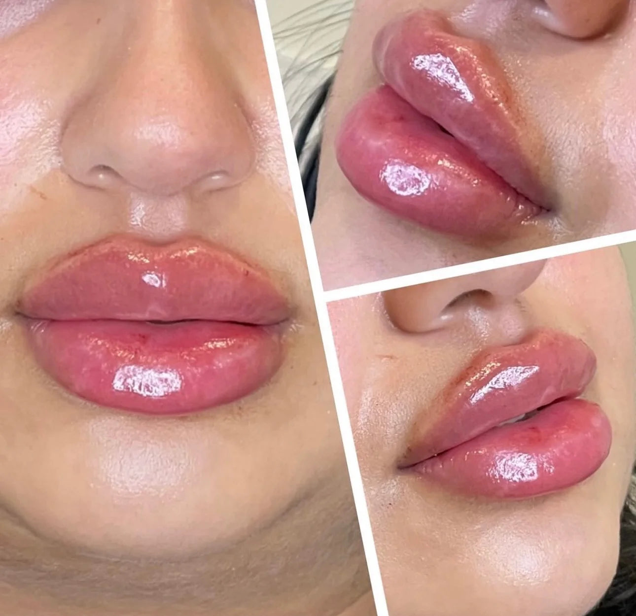 BP Spicule Plump Lip Shot Instantly Volumis Increase Lip Elasticity Long-lasting Moisturize Lip Plumper Gloss Sexy Beauty Makeup Qme