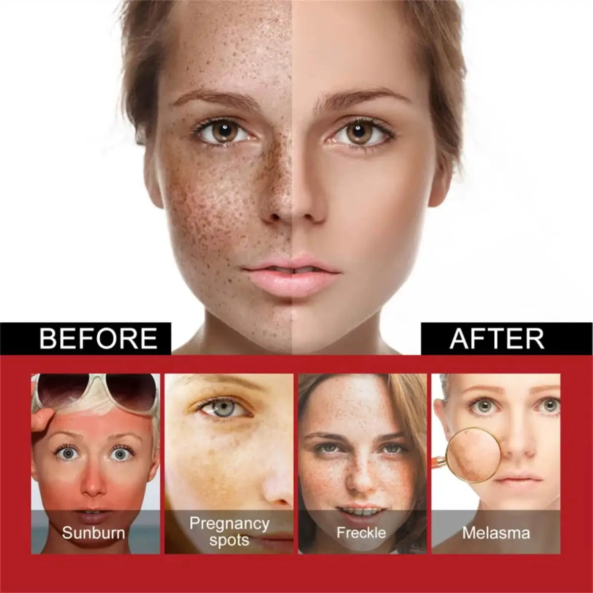 Whitening Freckle Cream Remove Dark Spots Anti Freckle Face Creams Niacinamide Fade Pigmentation Melasma Brighten Skin Care 20g Qme