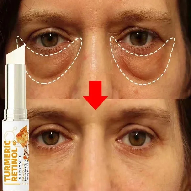 Instant Eye Bag Remove Eye Cream Anti Fat Particles Dark Circles Puffiness Fade Fine Lines Lift Brighten Korean Beauty Eye Care Qme