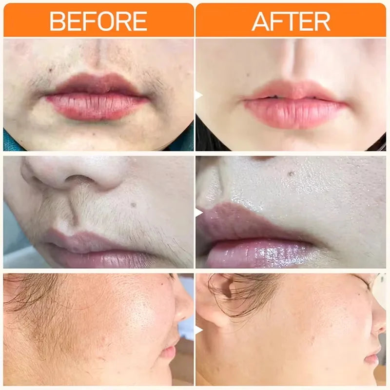 3 Minutes Painless Fast Hair Removal Cream Hair Growth Inhibitor Lip Face Arm Armpit Leg Permanent Depilatory for Men Women Care Qme