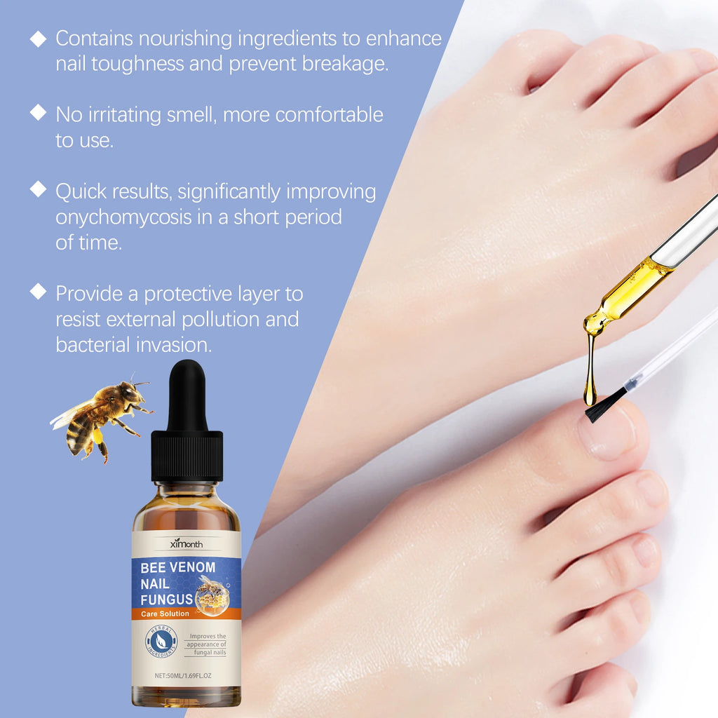 Bee Venom Nail Fungus Care Solution Maintenance Repair Nail Discoloration Thick Hand Foot Nail Manicureed Health Care Essence Qme