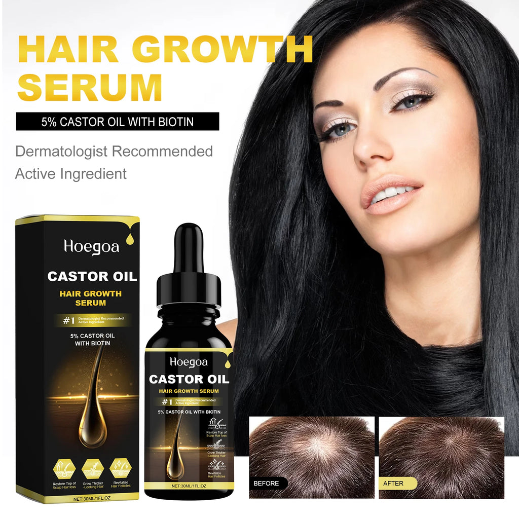 30ml Castor Oil Hair Thickening Essential Oil Nourish Scalp Massage Refreshing Hair Growth Repair Smoothing Hair Care Oil Qme