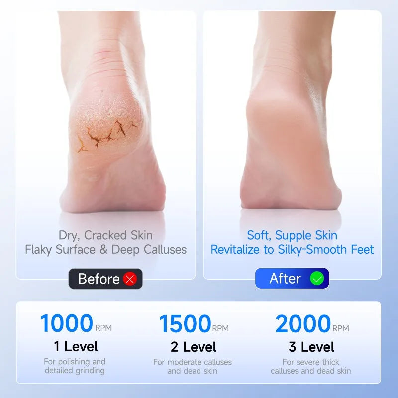 Auto Electric Foot File Dead Skin Remover Rechargeable Pedicure Tool Qme