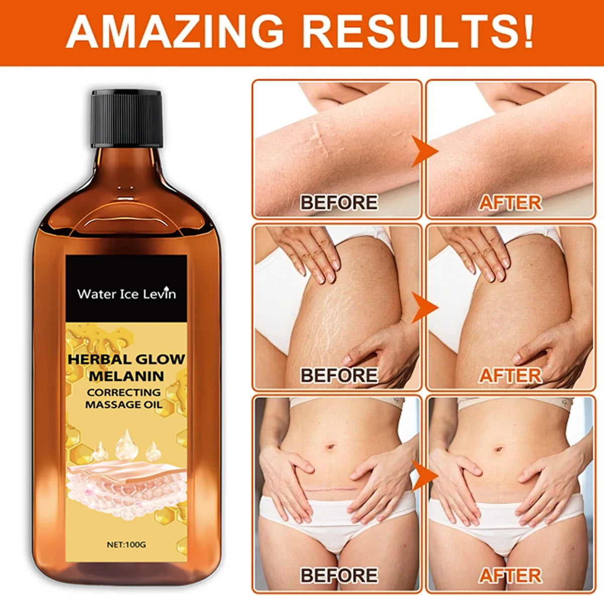 Herbal Glow Melanin Correcting Massage Oil with Bee Venom & Vitamin C - Brightening & Deeply Moisturizing for All Skin Types Qme