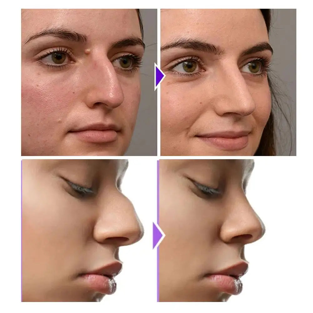 Nose Sculpting Device Nose Shaper Clip Soft Silicone Nose Up Lifting Device Nose Slimmer For Wide Big Nose NO Pain Beauty Tool Qme