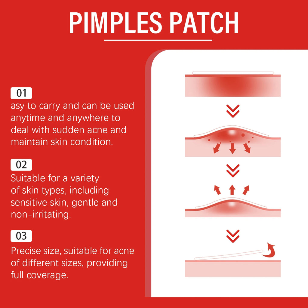 240Pcs Salicylic Acid Acne Pimple Patches Colorful Round/Heart/Flower/Star Shape Acne Removal Skin Care Stickers Covering Zits Qme