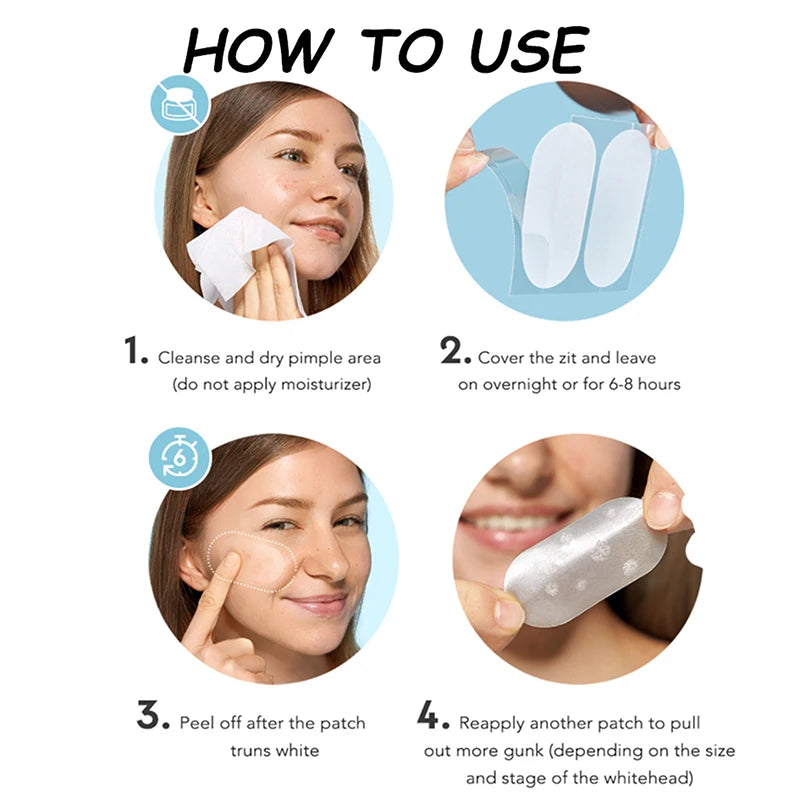 Invisible Acne Patches Anti-acne Spot Treatment Blemish Concealer Qme