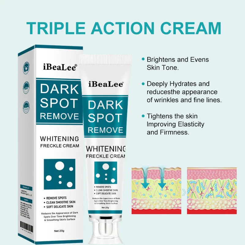 Melasma Brightening Face Cream Niacinamide Serum Brighten Cream Fade Fine Lines Lighten Dark Dot Reduce Melanin Face Skincare Qme