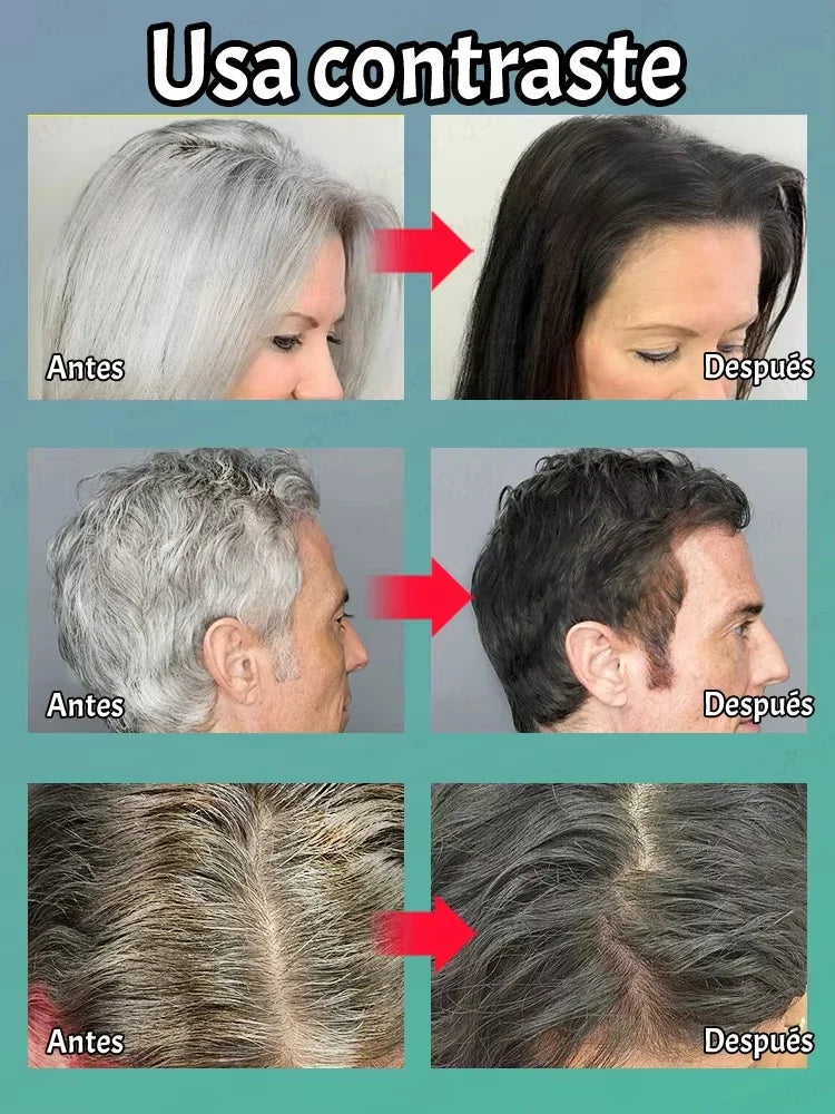 Natural antigen serum: Recover dark hair within 7 days and prevent 98% gray hair appearance - Plant extract Qme