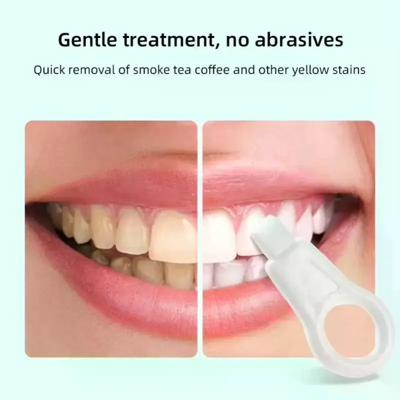3 Scaling Wipe Off Tartar Toothbrush Adults Stain Plaque Removal Qme