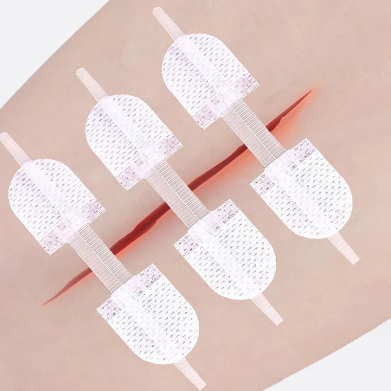 Strap Zipper Wound Closure Patches Care Braces Supports Breathable Qme