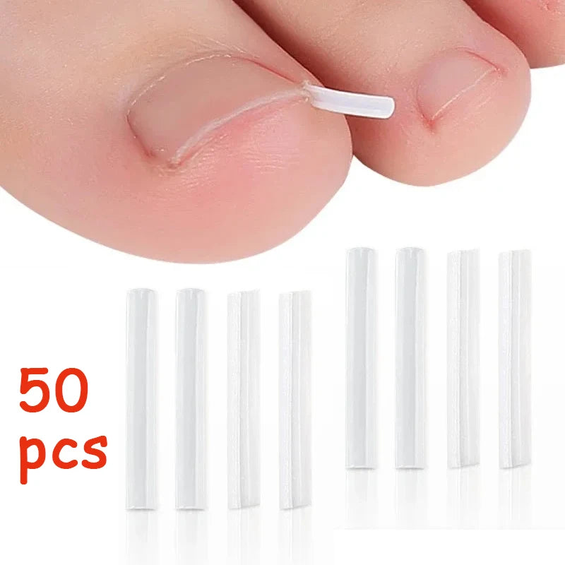 Inward Toe Nail Shaping Tool Invisible Care Pad Groove Adjust Clip Qme 50pcs