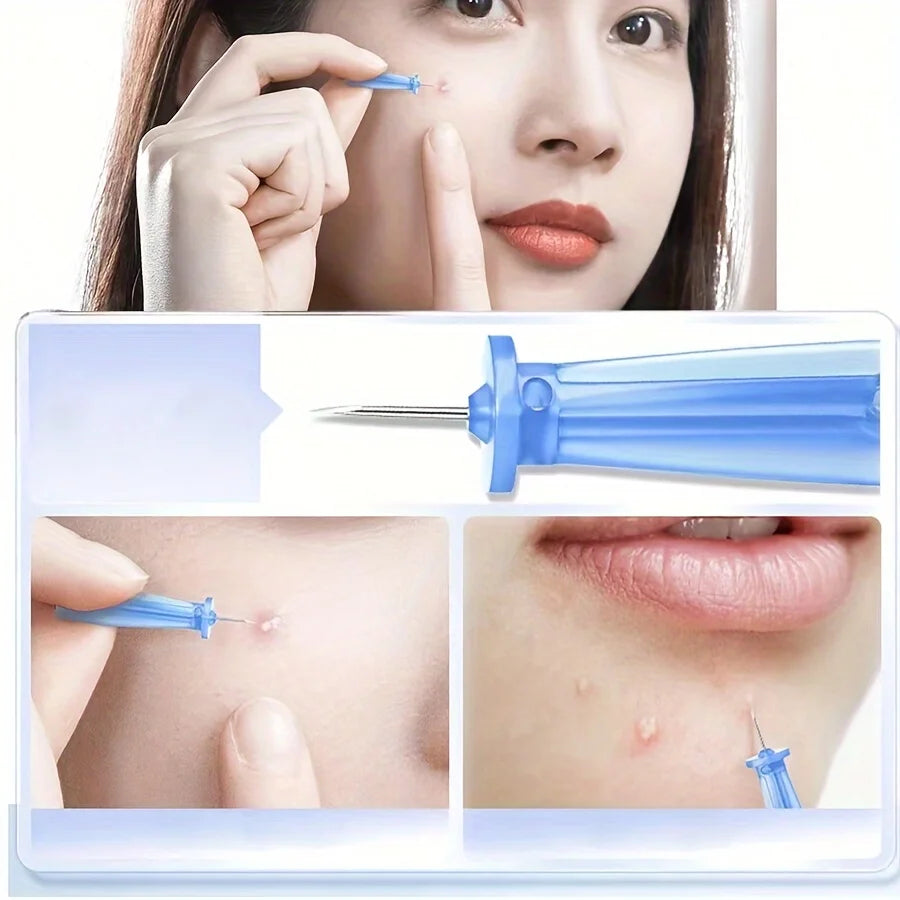 Super fine needles, closed needles, blackhead and pore-clearing needles, squeezing needles, and cleaning kits Qme