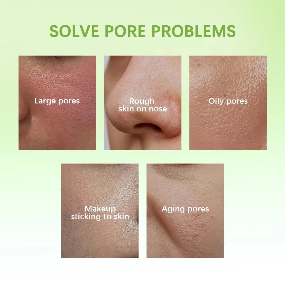 30ml Oil Control Pore Essence Milk Smoothes Pores And Moisturizes Skin With A Refreshing Non-greasy Essence Skin Care Products Qme
