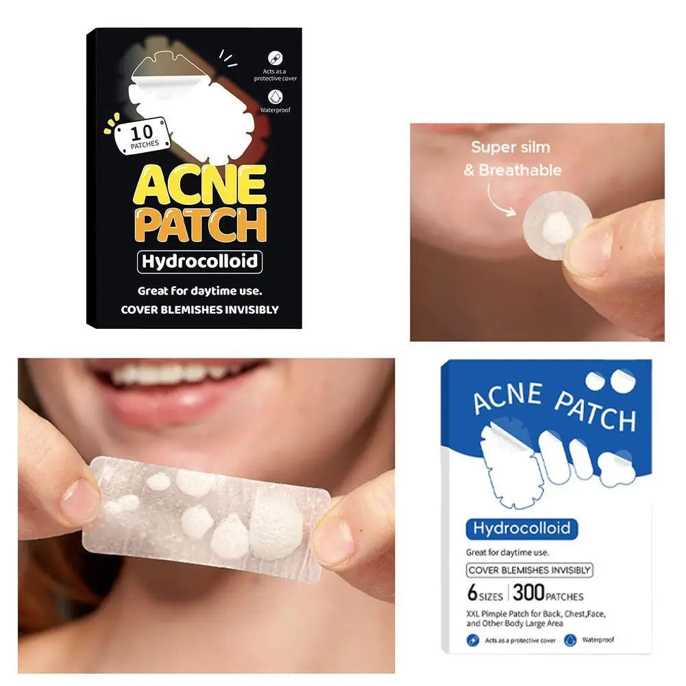 1/10/300pcs Special shaped acne patch Invisible Pimple Cover For Face Oil Control Spot Treatment Sticker Acne Tool Qme