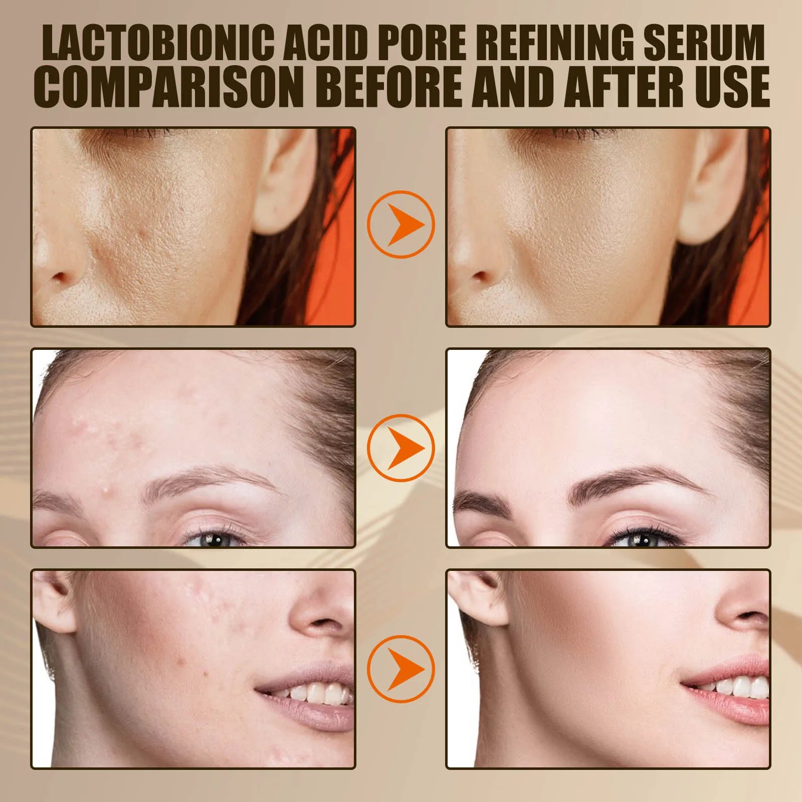 Lactose Acid Shrink Pores Serum Moisturizing Remove Blackheads Repair Face Pores Skin Firming Brighten Nourish Face Essence Qme