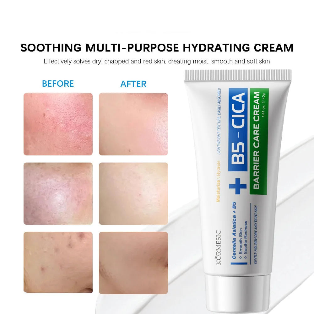 B5 Repair Cream Moisturizing Hydrating Soothing Dry Chapped Redness Skin Nourishes Hydrating Barrier Support Beauty Face Cream Qme
