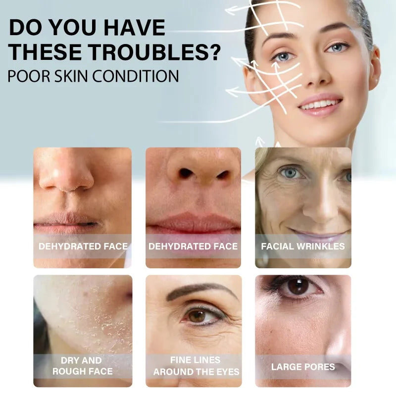 60Pcs Gold Protein Line Fade Wrinkle Firming Facial No Needle Absorbable Smoothing Hydrolyzed Collagen Thread Serum Qme