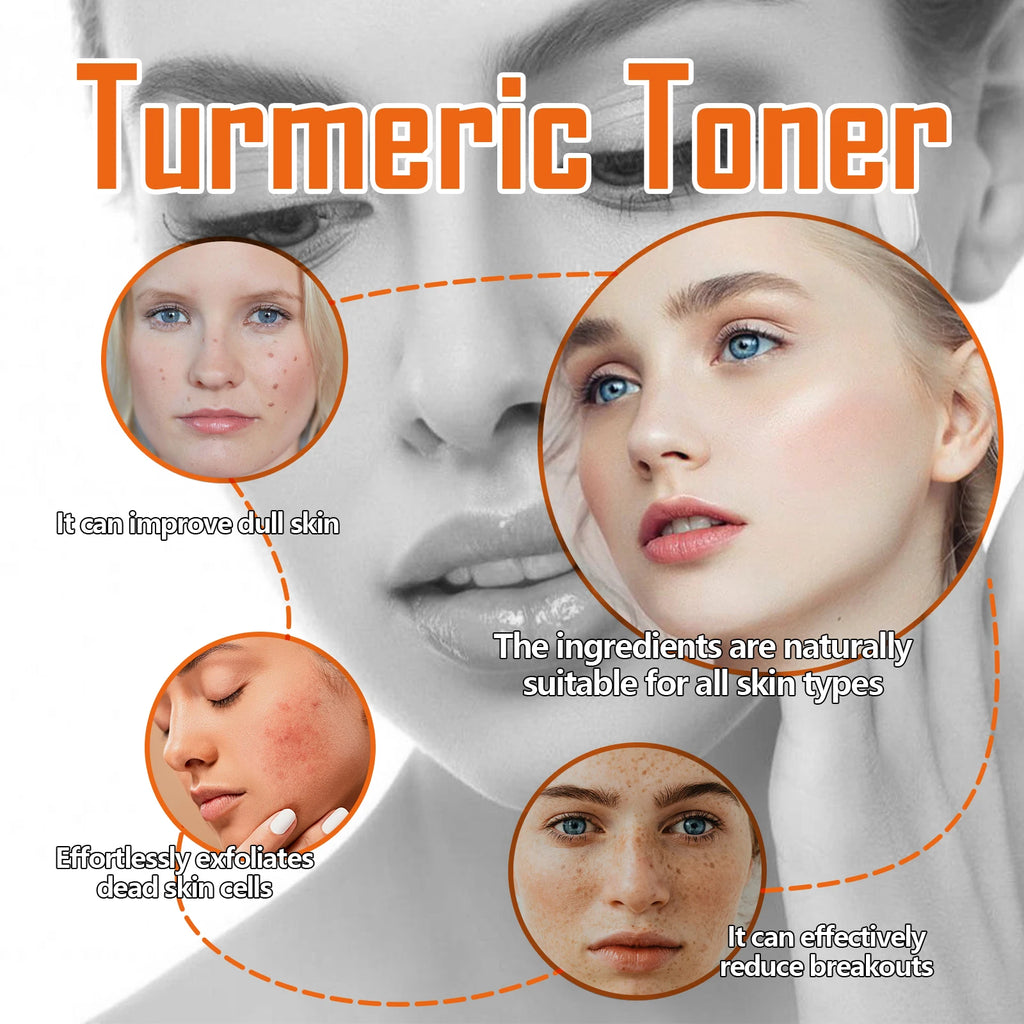Turmeric Toner Dark Spots Removal Brightening Spots Corrector Remove Freckle Fade Melasma Moisturizing Turmeric Face Toner Qme