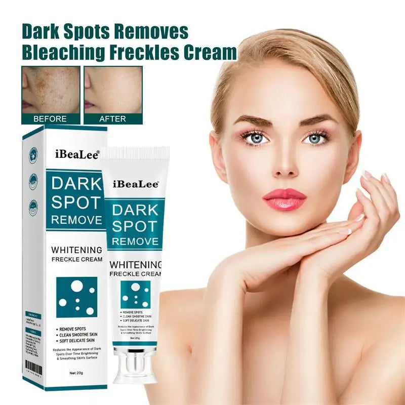 Melasma Brightening Face Cream Niacinamide Serum Brighten Cream Fade Fine Lines Lighten Dark Dot Reduce Melanin Face Skincare Qme