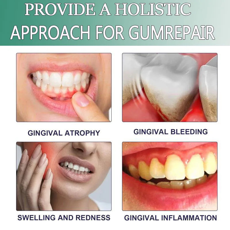 Damaged Gum Repair Care Gel Relieve Sore Gums Allergy Deep Cleaning Teeth Stains Tartar Serum Dental Caries Toothpaste Qme