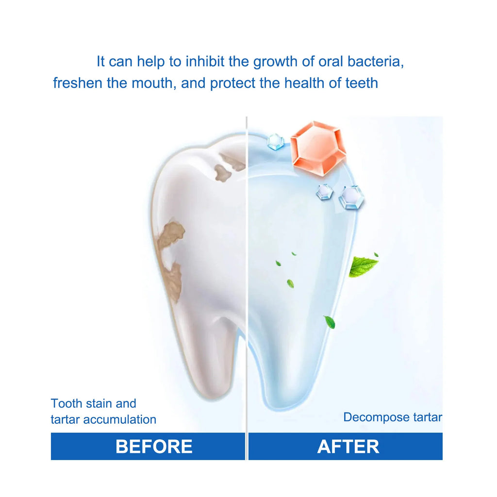 SP Probiotic Toothpaste Whiten Toothpaste Clean Mouth Stain Remove Fresh Breath Soft Foam Protect Gum Whiten Teeth Oral Care Qme
