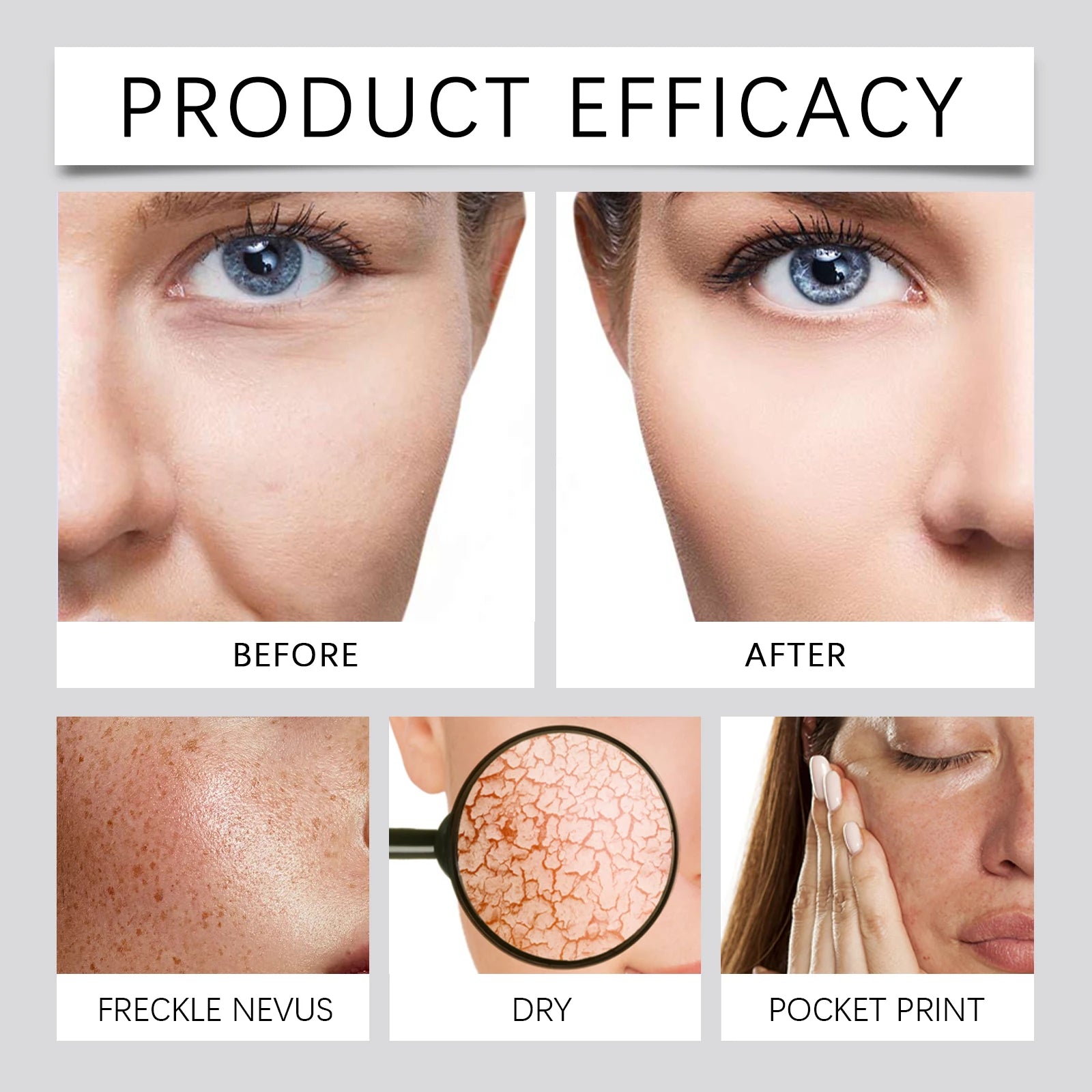 Moisturizer Facial Cream Facial Cream Anti Wrinkle Face Moisturizer Cream Contains natural plant ingredients Acne Qme