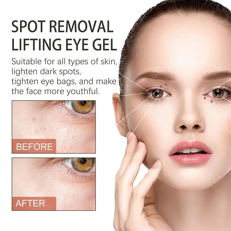 Fat Granules Remover Eye Cream Anti-Puffiness Anti Inflammatory Reduce Dark Circles Eyebags Fade Lines Moisturizing Eye Care Qme