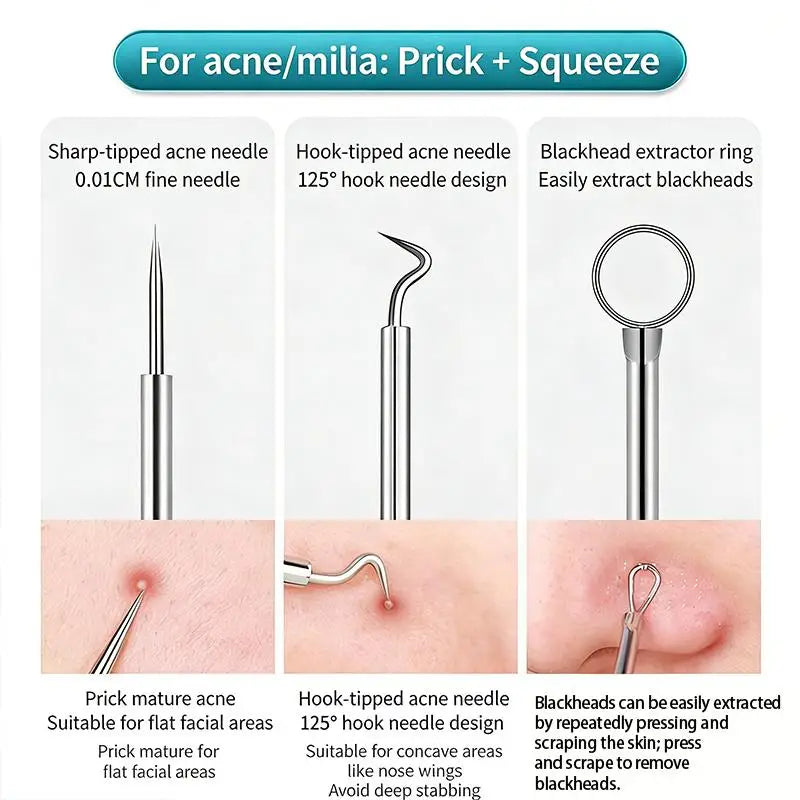 Ultra-precise Acne Blackhead Removal Tool Pimple Tweezers Effective Qme