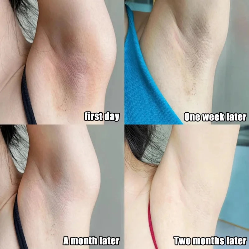 Whitening Cream Private Parts Underarm Bleaching Serum Whiten Butt Knee Brighten Inner Thigh Intimate Parts Dark Remove Melanin Qme