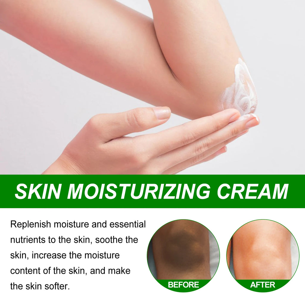 Retinol Whitening Cream for Dark Skin Knee Buttocks Underarm Butt Inner Brightening Private Part Remove Melanin Bleaching Cream Qme