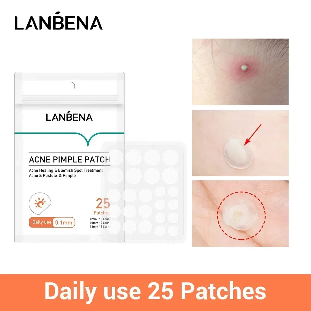 LANBENA Acne Pimple Patch 25pcs Daily Use Invisible Acne Stickers Blemish Treatment Acne Concealer Makeup Qme
