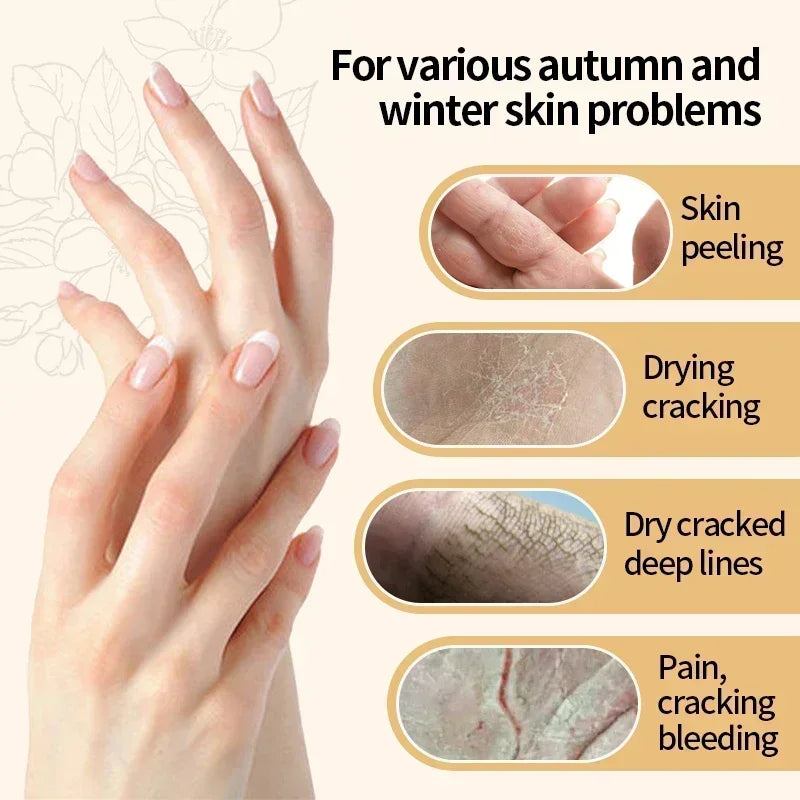 Kojic Acid Anti-wrinkle Hand Cream Skin Soften Nourish Anti-drying Qme