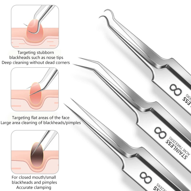 Skin Care Tool Tweezers Beauty Salon Remover Acne Needleultra-fine Qme