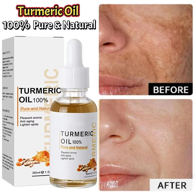 Turmeric Repair Essence For Reduces Dark Spots & Freckles Moisturizes Face Brightens And Evens Skin Tone Improves Damaged Skin Qme