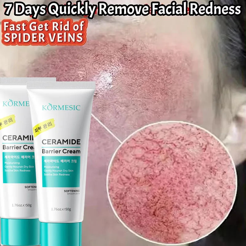 Facial Redness Reduce Cream Improve Sensitive Skin Dryness Moisturizer Hydrating Sooth Lotion Rosacea Decrease Korean Cosmetics Qme 1pc 1