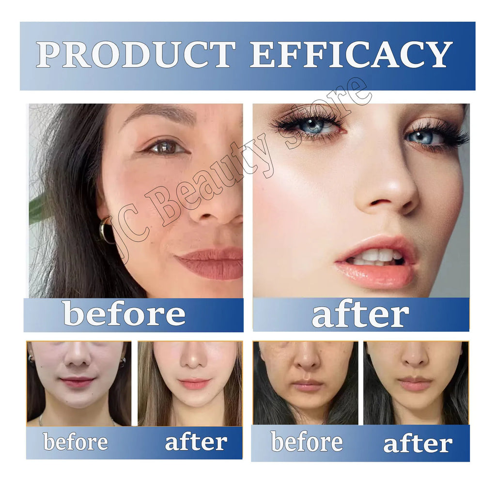 3/5/10PC Collagen Wrinkle Reduce Patch Retinol Fade Fines Lines Lift Firm Tighten Skin Mask Korean Moisturizing Skin Care Patch Qme