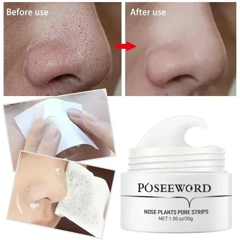 Efficient Blackhead Remover Nose Mask Pore Strip Black Peeling Acne Qme