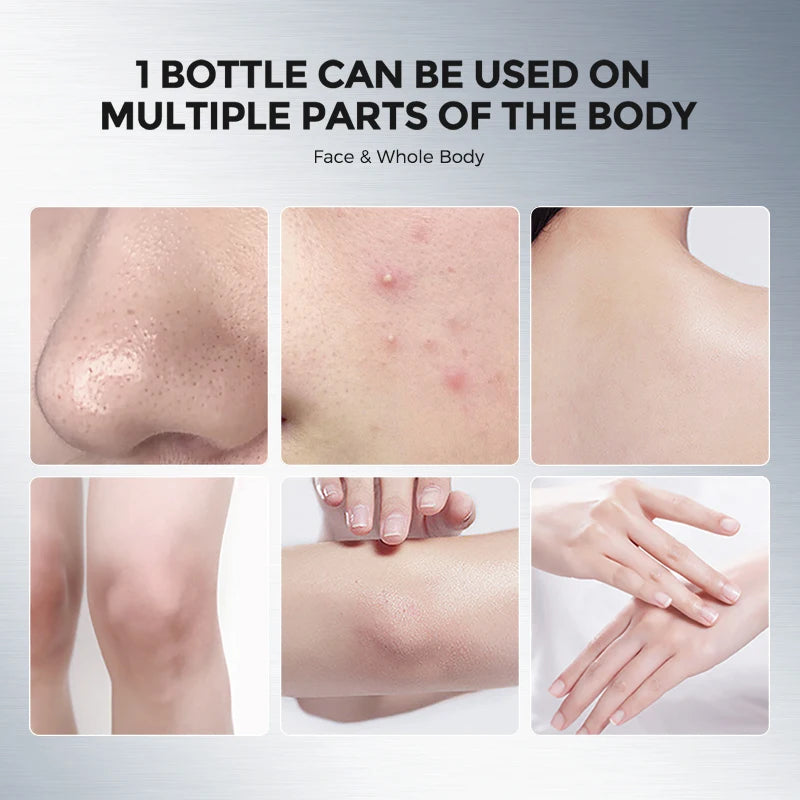 NING Exfoliating Gel Gentle Face Peeling Deep Pore Cleansing Qme