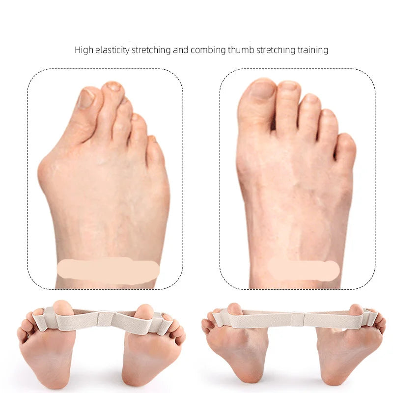 Hallux Valgus Corrector Big Toe Stretcher Separator Bunion Soothing Qme
