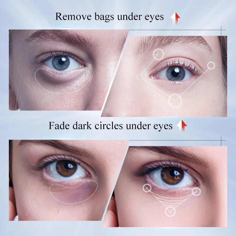 Kojic Acid Retinol Eye Cream Recuce Eye Dark Circles Decrease Eye Bags Moisturizing Firming Beauty Eyes Skin Care Products Qme
