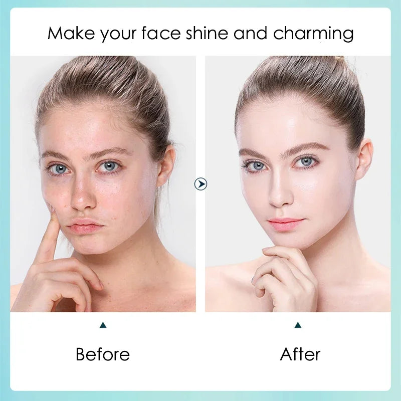 Hyaluronic Acid Hydrating Facial Mask Sheet Masks Face Shrinking Qme