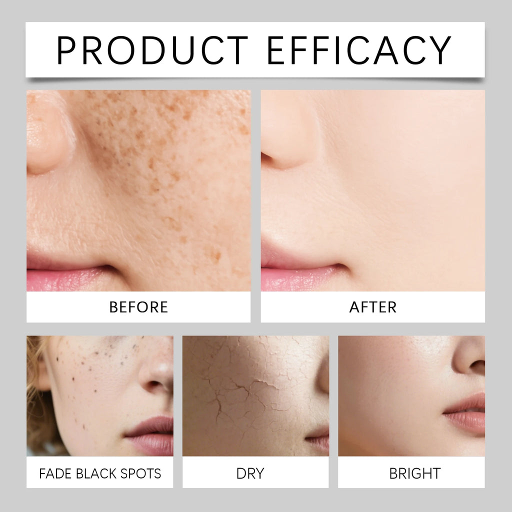 Papaya VC Brightening Serum Improve Dullness Remove Dark Spots Effective Whiten Freckle Product Moisturize Face Skin Care Beauty Qme