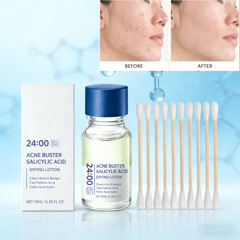 Salicylic Acid Acne Buster Remover Blackhead Oil Control Tenderizing Delicate Pores Pimple Spot Remover Facial Skin Care Essence Qme