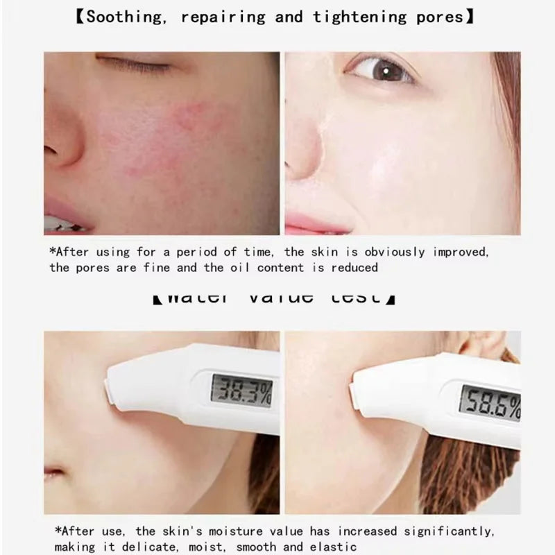 BIOAQUA Centella Collagen Face Mask Moisturizing Refreshing Sheet Masks Hyaluronic Acid Facial Mask Skin Care Products Qme