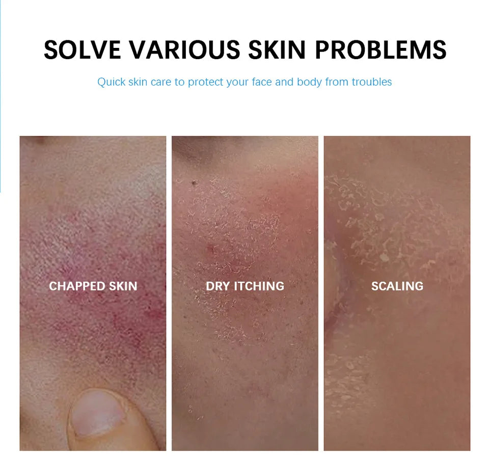Facial Redness Repair Cream Improve Sensitive Skin Dryness Hydrating Sooth Lotion Removal Rosacea Day Night Korean Cosmetics Qme