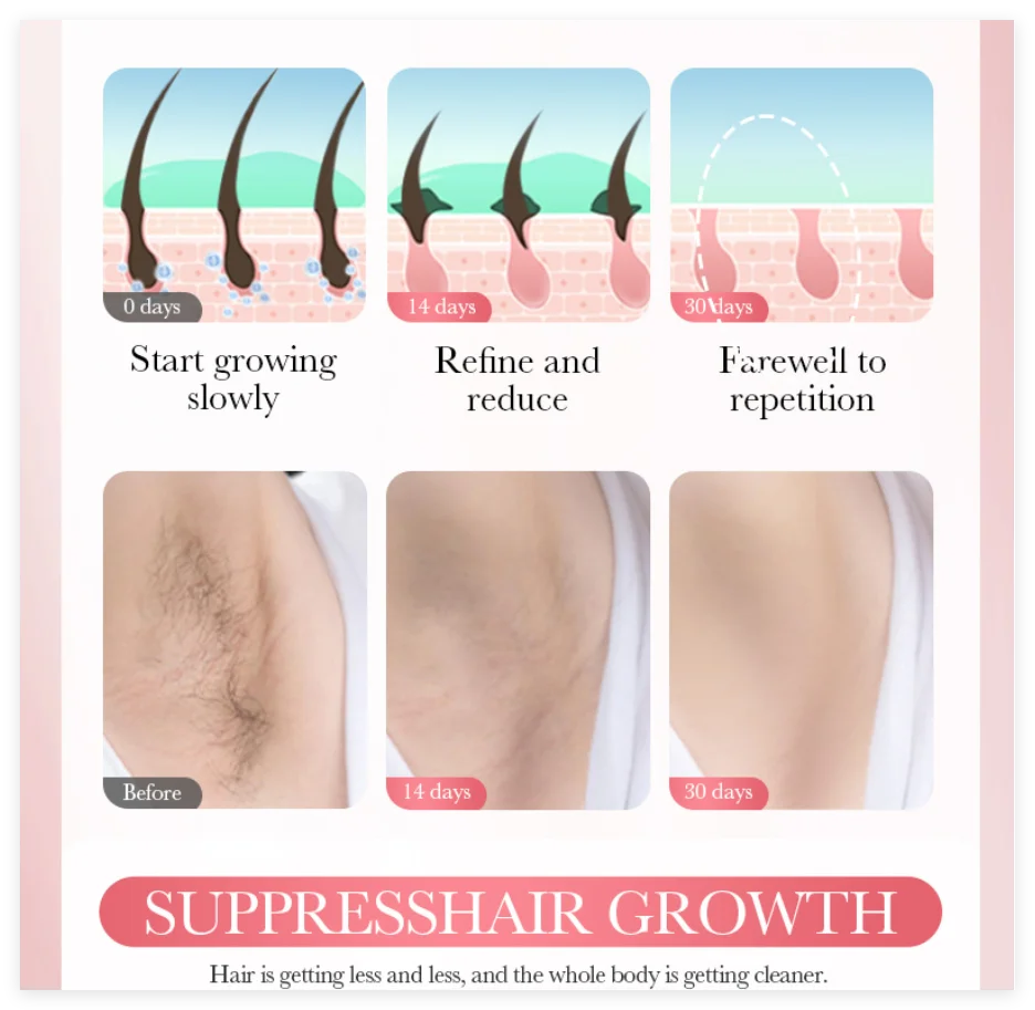 Permanent Hair Removal Cream Hair Growth Inhibitor Face Arm Armpit Leg Intimate Areas Painless Depilatory For Men Women Care Qme