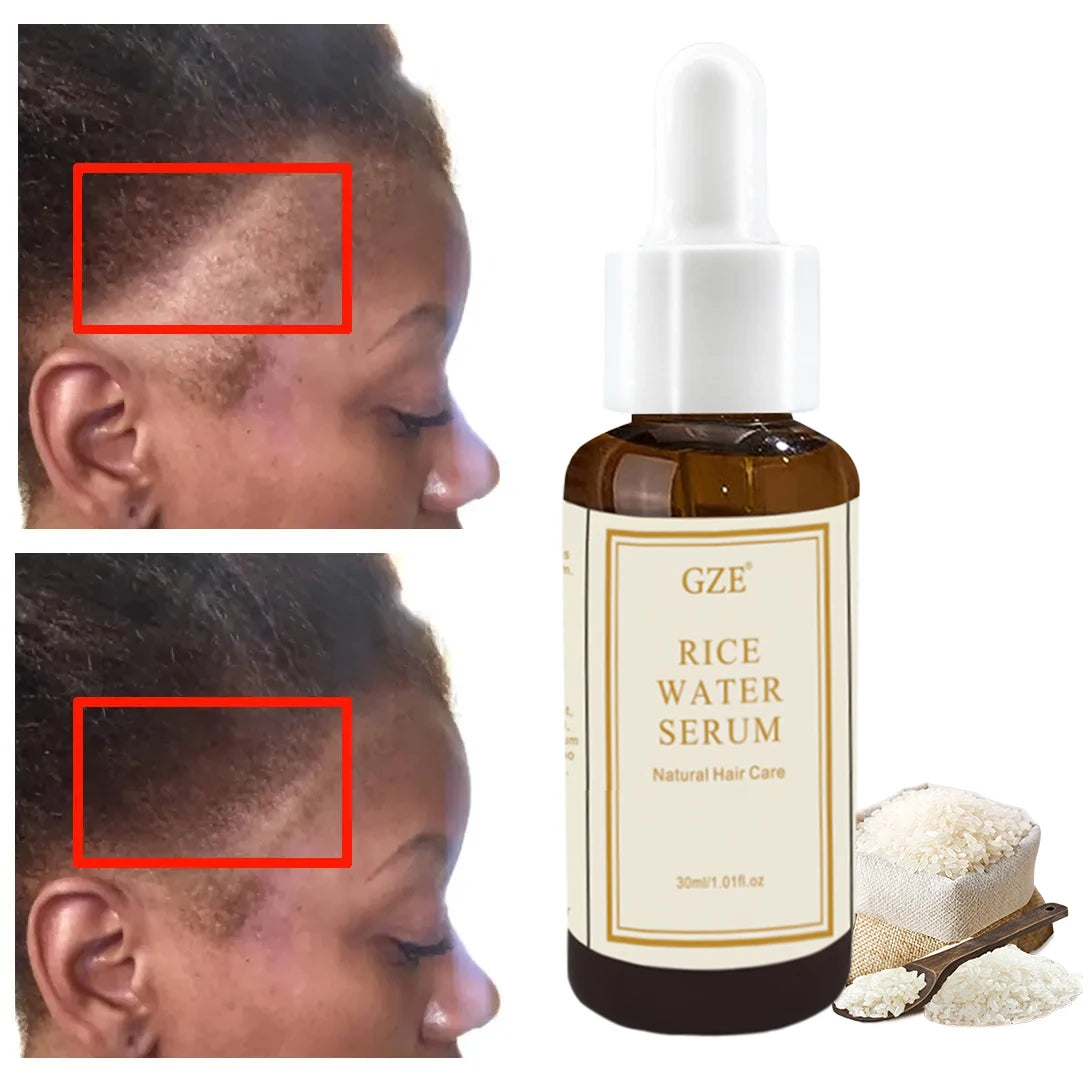 GZE Organic Rice Water Serum For Hair Gr th, Skincare, Rice Water Essential Oil Revitalize and Strengthen Hair for Men and Women Qme GZE092